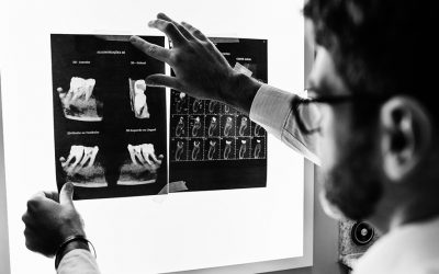 Case Study: Providing an Expert Second Opinion on Dental X-Rays